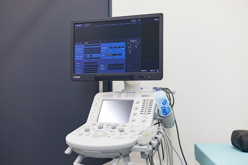 超音波診断診断装置